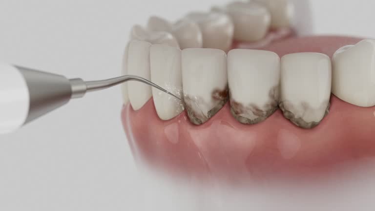 Reliable Dental contractor in Desoto Lakes, FL by Dentist Open Now